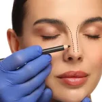 silicon-rhinoplasty-after-10-years-1000x480-1-150x150