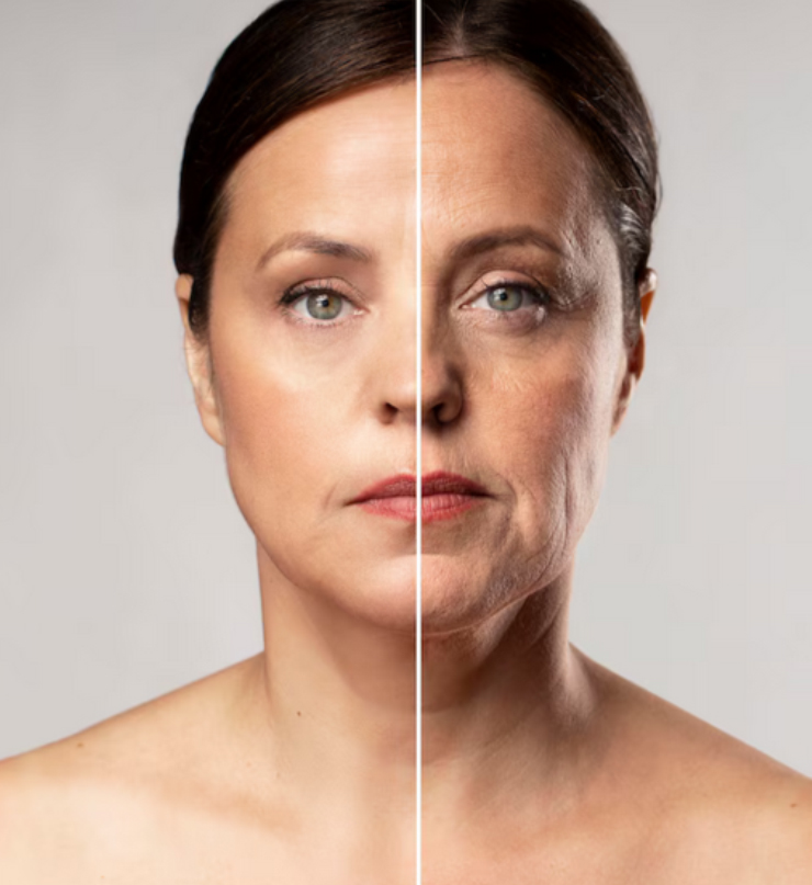 Eyebrow and neck lift