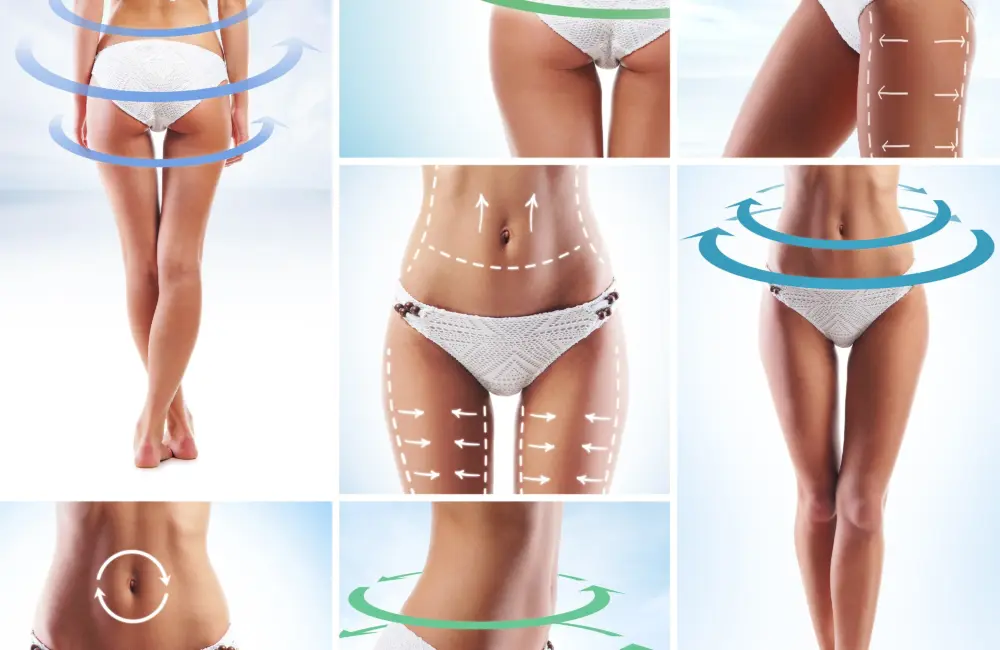 liposuction-blog-picture2-min-1000x650